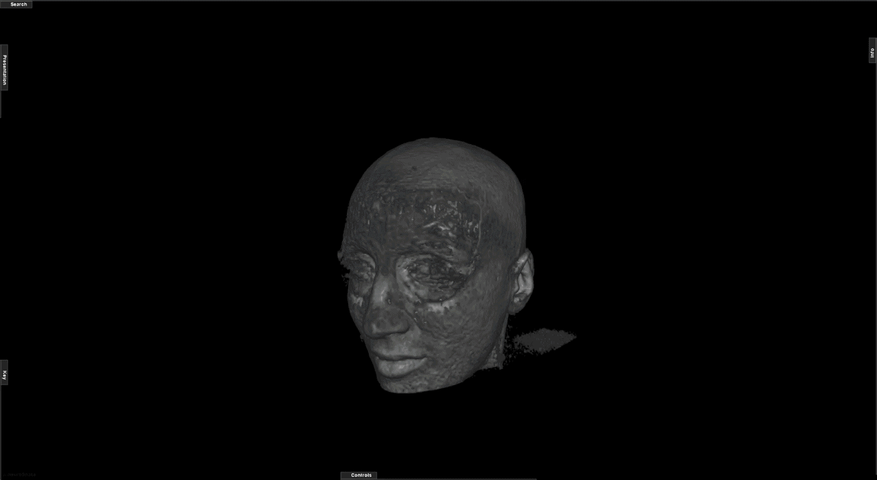 Animated Functional Suite Electrode Mapping media